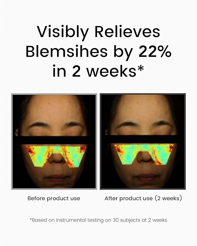 Korean DOMINAS Retinol Serum for Face (1fl oz) – Youth Rejuvenating Face Ampoule for Improving Fine Lines & Reducing Pigmentation, Skin Care for Day & Night Use. Vitamin C, Niacinamide, Peptide